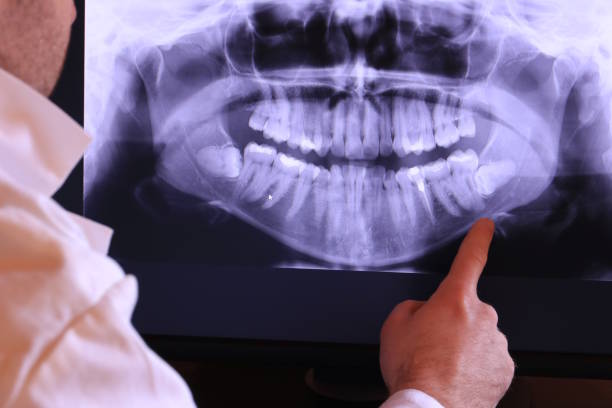 Best Cracked Tooth Emergency Dentist  in Timber Pines, FL