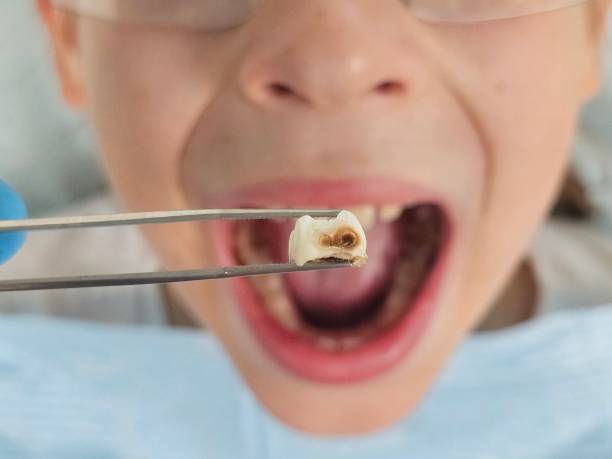 Best Urgent Tooth Repair  in Timber Pines, FL