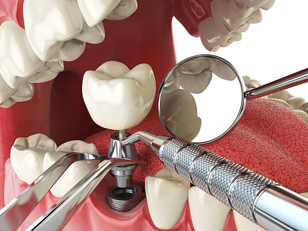 Best Broken Tooth Emergency  in Timber Pines, FL